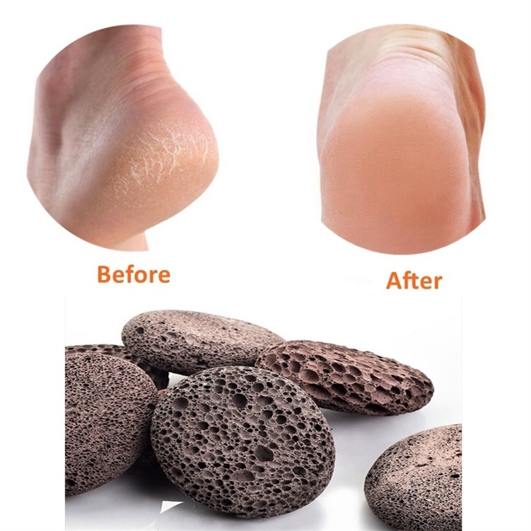 Realong Wholesale Foot Callus Remover Scrubber Brown Oval Shape Exfoliating Natural Earth Lava Pumice Stone