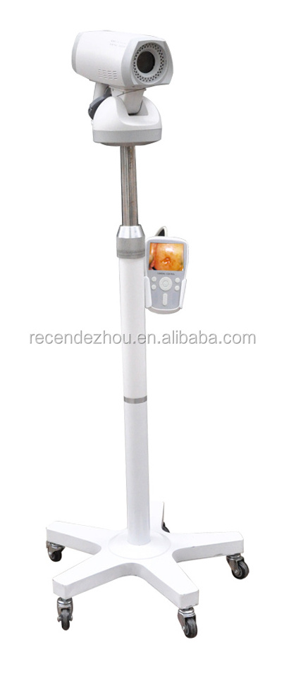 Newest Portable Video Colposcope for vaginal/Digital colposcope with SONY camera gynecological Colposcope for sale BO-GY02