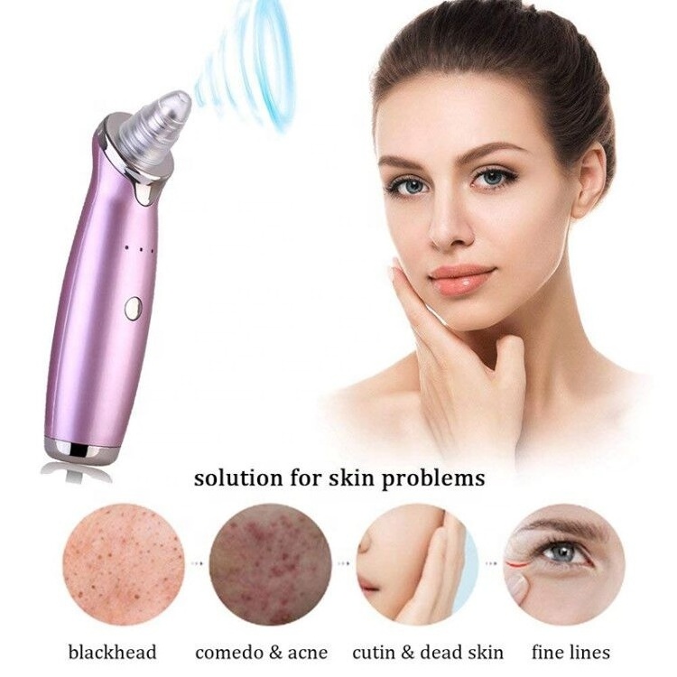 Professional cheaper price pores cleaner blackhead vacuum blackheads and pimple extractor