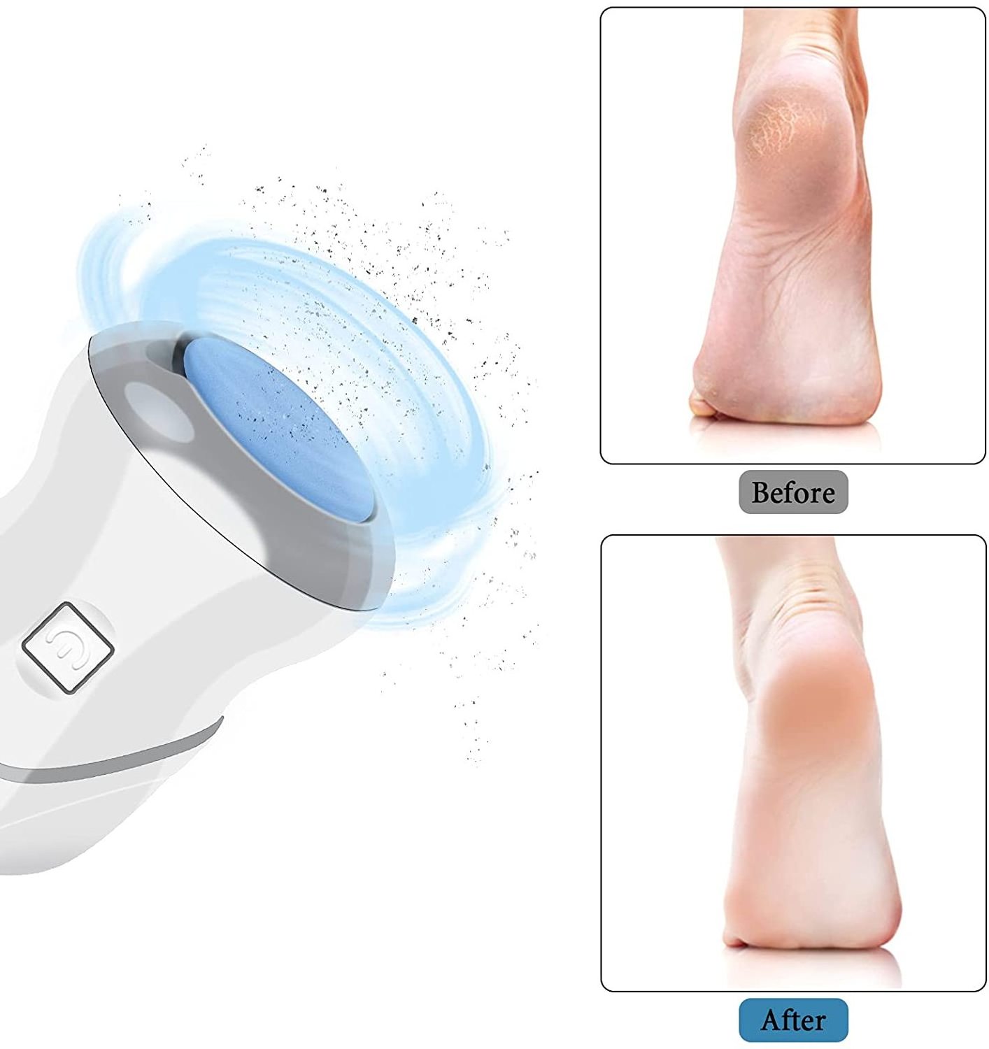 Feet Callus Removers Rechargeable Electronic Foot File Pedicure Tools Foot Care Callus Remover Kit for Hard Cracked Dry Skin