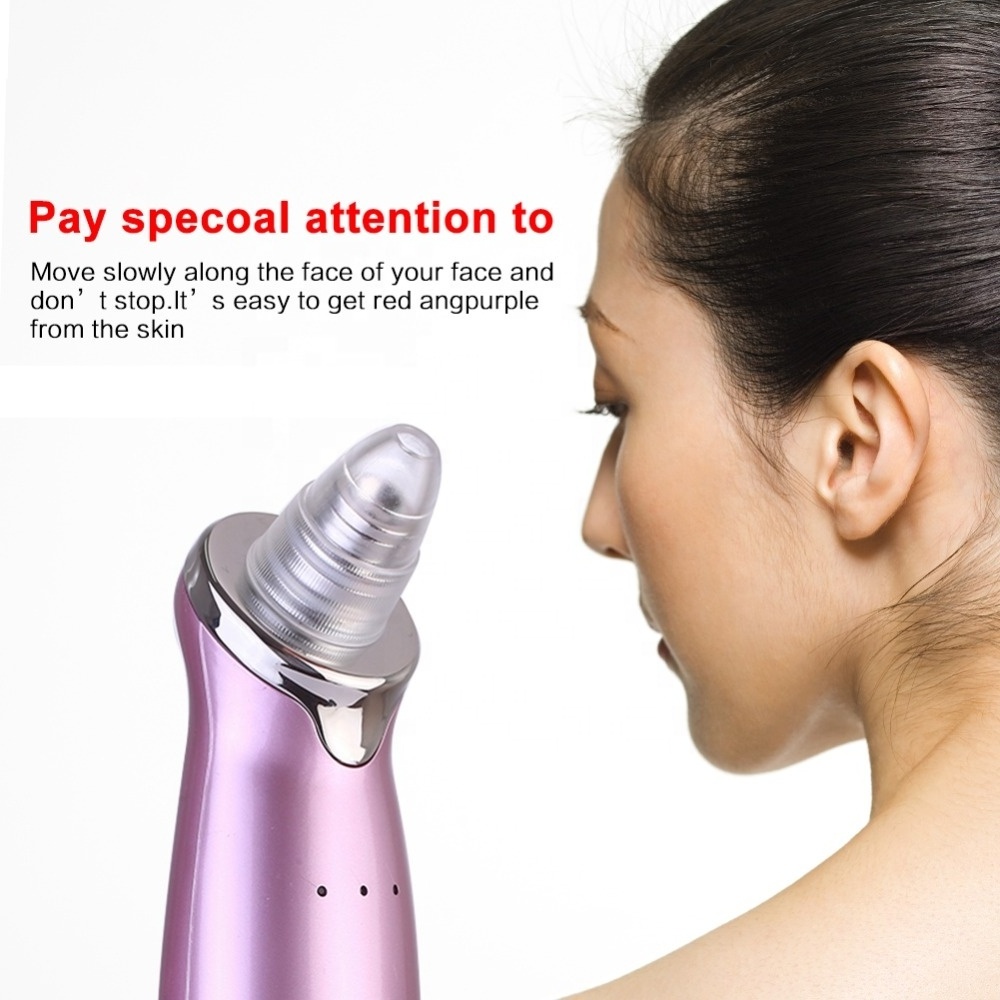 Professional cheaper price pores cleaner blackhead vacuum blackheads and pimple extractor