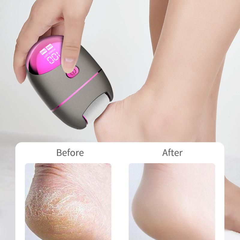 LH-301 Electric Callus Remover for Feet Rechargeable Foot File Hard Skin Remover Waterproof Dead Skin with 3 Roller Heads