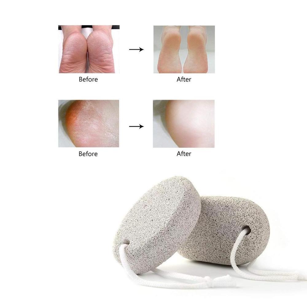 Lava Pedicure Tools Hard Skin Callus Remover Foot Pumice Stone for Feet ,natural Foot File Exfoliation to Remove Dead Skin White