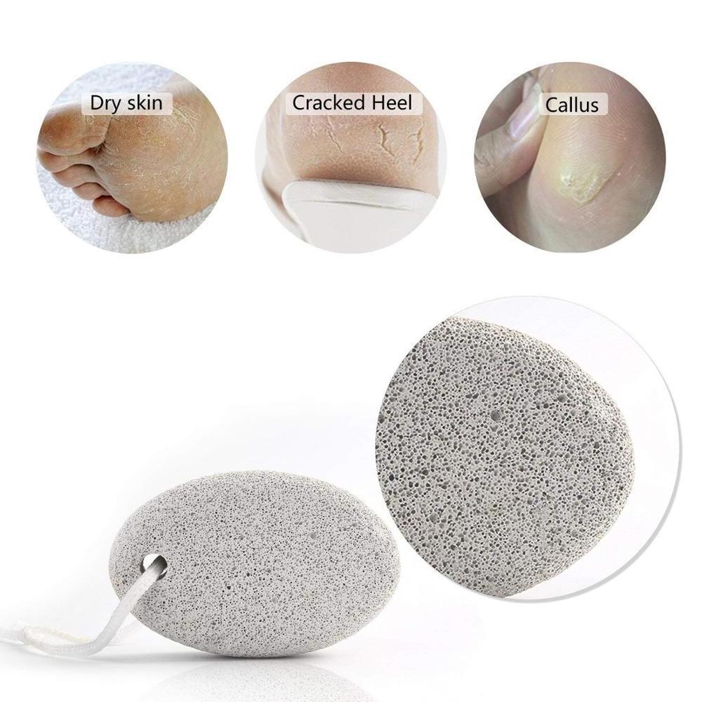 Lava Pedicure Tools Hard Skin Callus Remover Foot Pumice Stone for Feet ,natural Foot File Exfoliation to Remove Dead Skin White