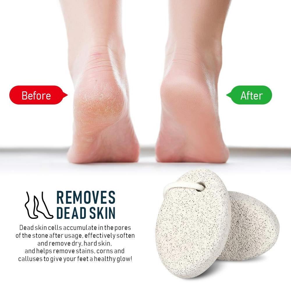 Natural Lava Pedicure Tools Hard Skin Callus Remover and Foot File Exfoliating Pumice Sponge for Feet and Body Scrubbing