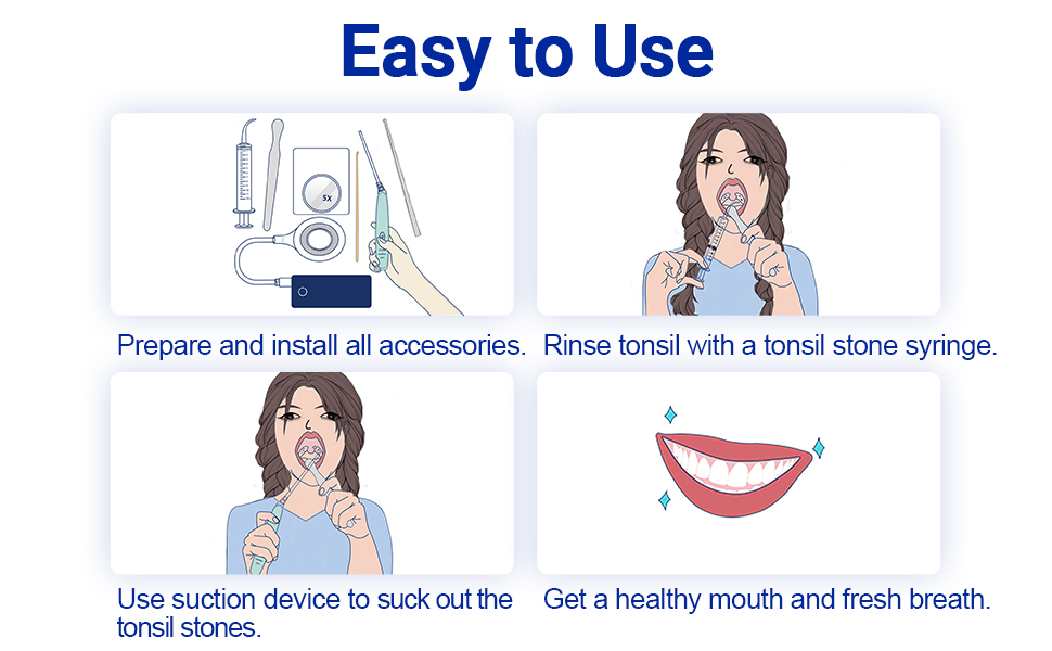 Electronic Tonsil Stone Remover Vacuum Removal Kit - Hassle-Free Tonsil Stone Instant Suction Tools