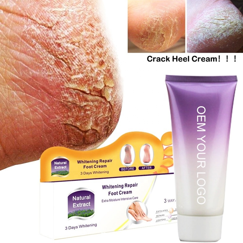 Cuidado De Lcremas Para Os Pies Anti Cracked Heel Footmask Exfoliating Feet Foot Peeling Scrub Mask Whitening Spa Repair Cream