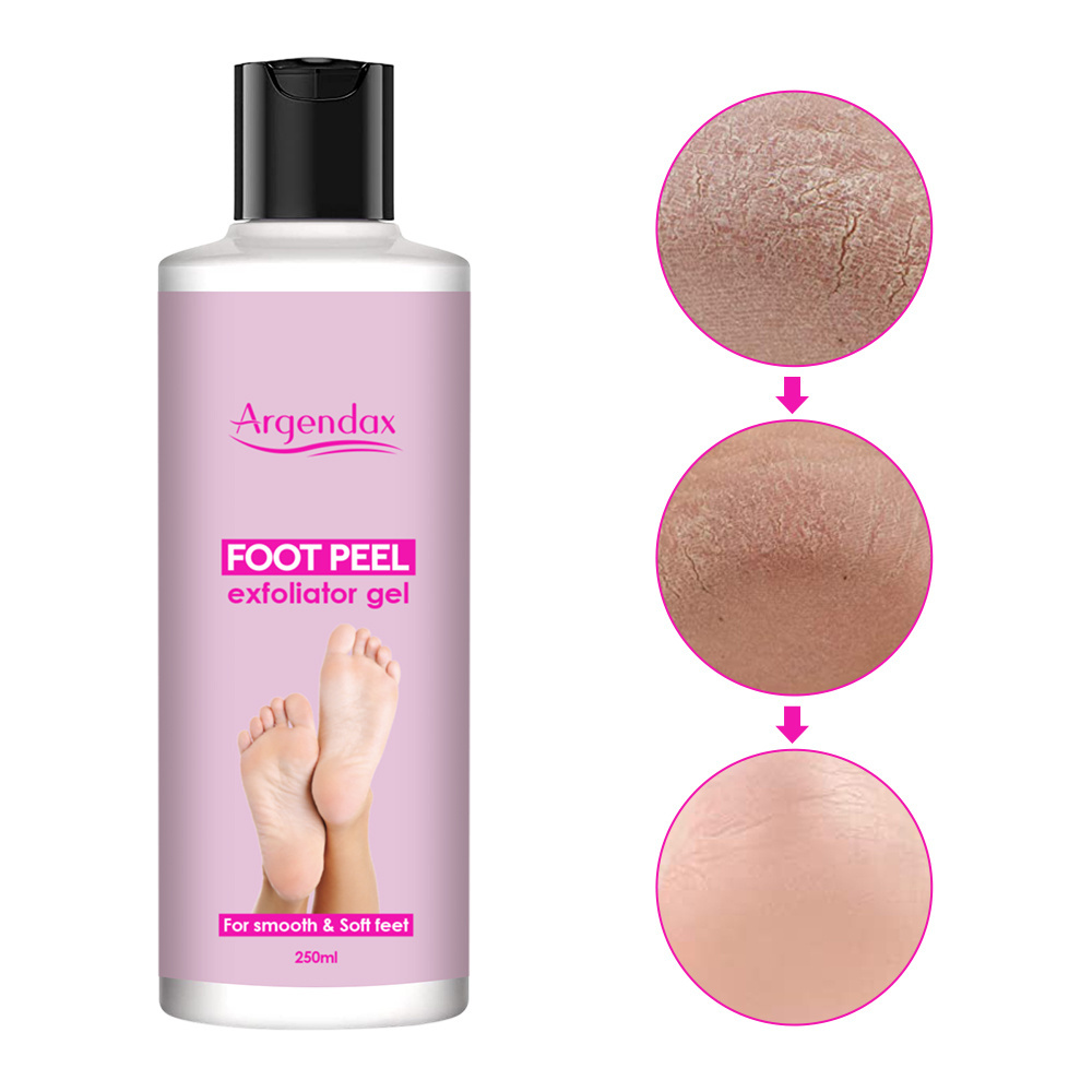 Private label 250ml organic moisturizing anti inflammatory foot callus remover foot peel exfoliator gel