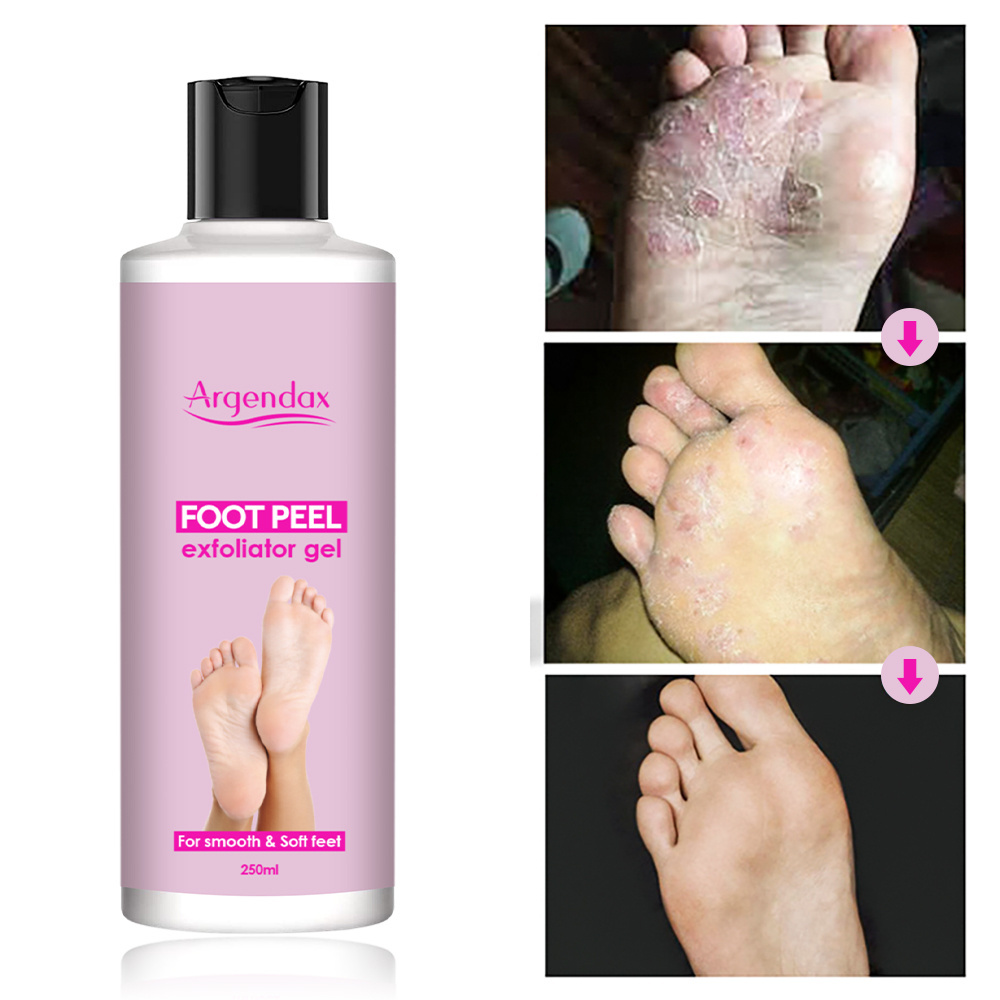 Private label 250ml organic moisturizing anti inflammatory foot callus remover foot peel exfoliator gel