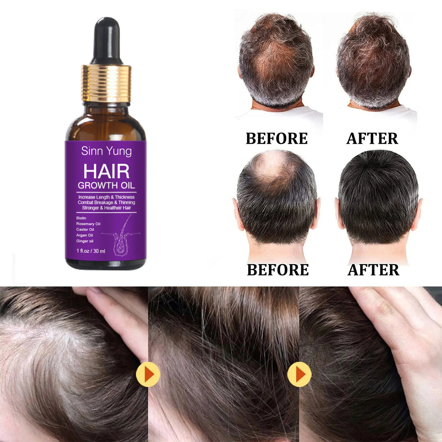 Private Label Wholesale Prevent Hair Loss Organic Herbal Biotin Castor Oil Rosemary Hair Growth Oil for Men