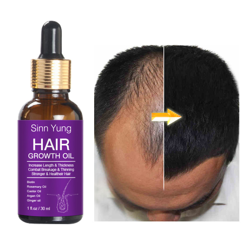 Private Label Wholesale Prevent Hair Loss Organic Herbal Biotin Castor Oil Rosemary Hair Growth Oil for Men