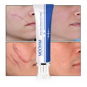 Strong Effective Acne Scar Removal Cream Pimples Stretch Marks Face Gel Tummy Tuck Tightening Stretch Mark Removal Cream