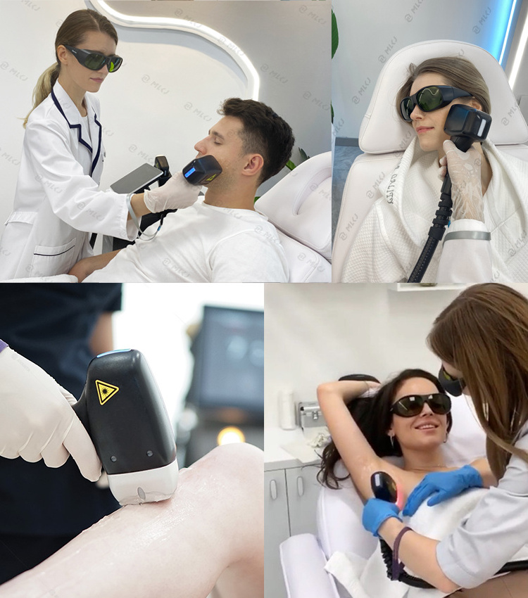 2024 Professional hair removal laser 1800W ice titanium laser hair removal 755 808 1064mm diode laser hair removal machine price