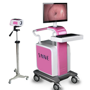 Colposcope for women vagina diagnosis,beautiful vagina colposcope camera