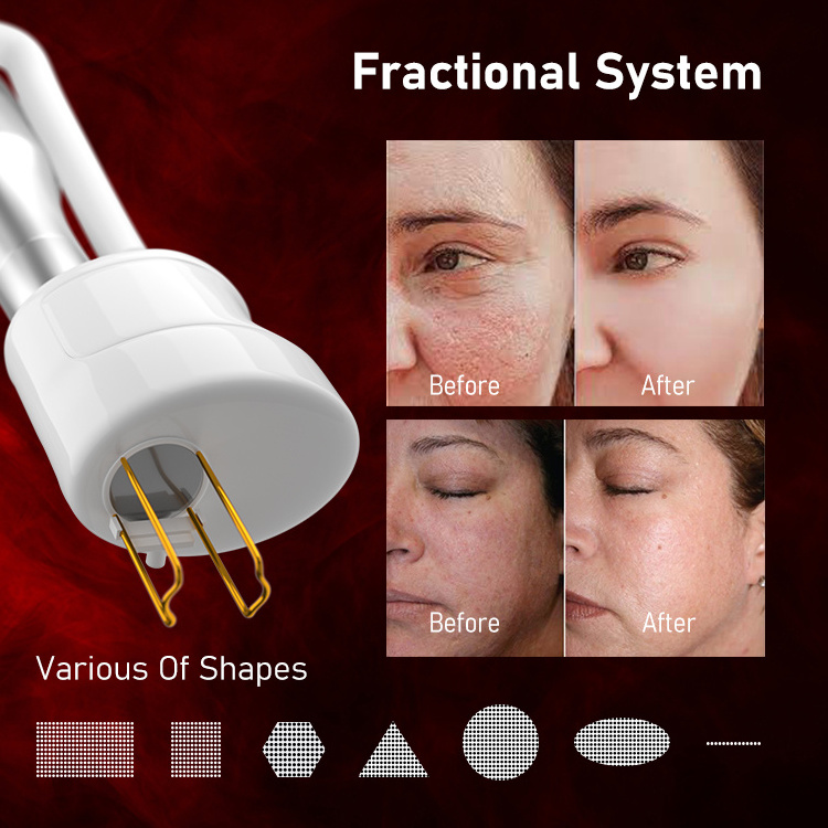 Korea Laser 10600nm Fractional Co2 Laser Acne removal Skin rejuvenation  +  980nm diode laser