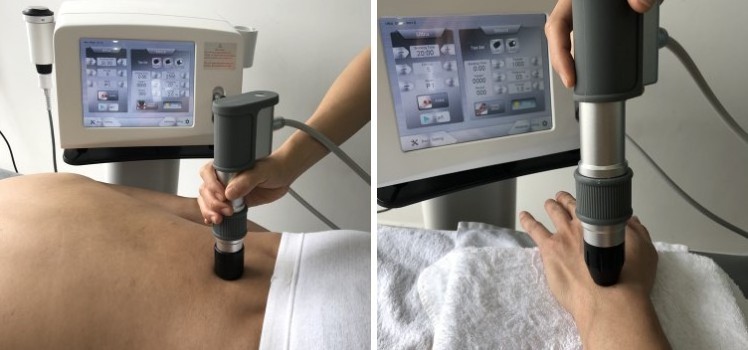 ultrasonic and shockwave therapy machine physiotherapy instrument 1 mhz physical therapy for pain relief  chronic inflammation