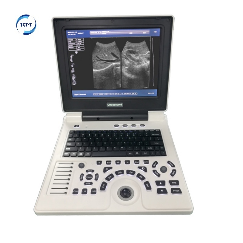 Veterinary Ultrasound Machine 15 inches Low Price Portable Animal Cow Cattle Vets Ultrasound Scanner