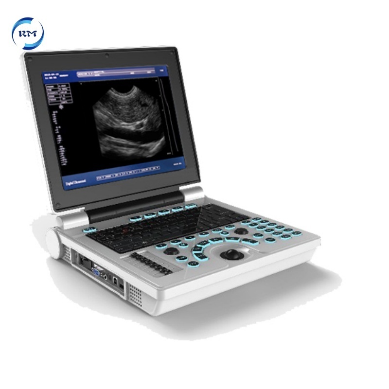 Veterinary Ultrasound Machine 15 inches Low Price Portable Animal Cow Cattle Vets Ultrasound Scanner