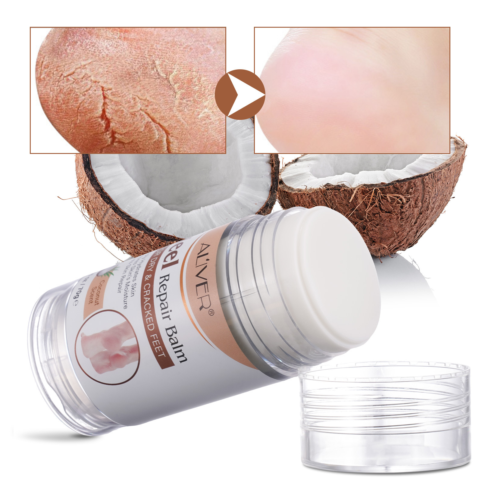 ALIVER coconut oil moisturizing foot care cosmetic cracked heel repair foot balm,private label custom foot balm stick