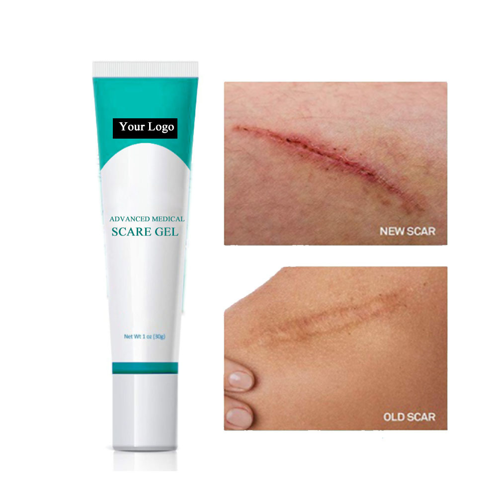 Medical Silicone Product Scar Remover Removal Gel Cream Ointment For Old Scars On Legs Clear Scars