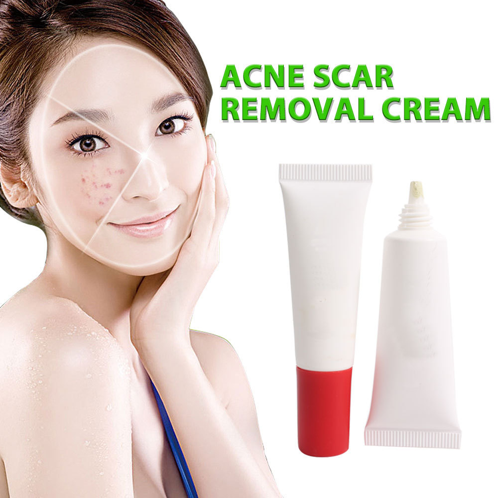 OEM and ODM Customized Private Label Remove Pimples Acne Face Scar Stretch Mark Removal Cream