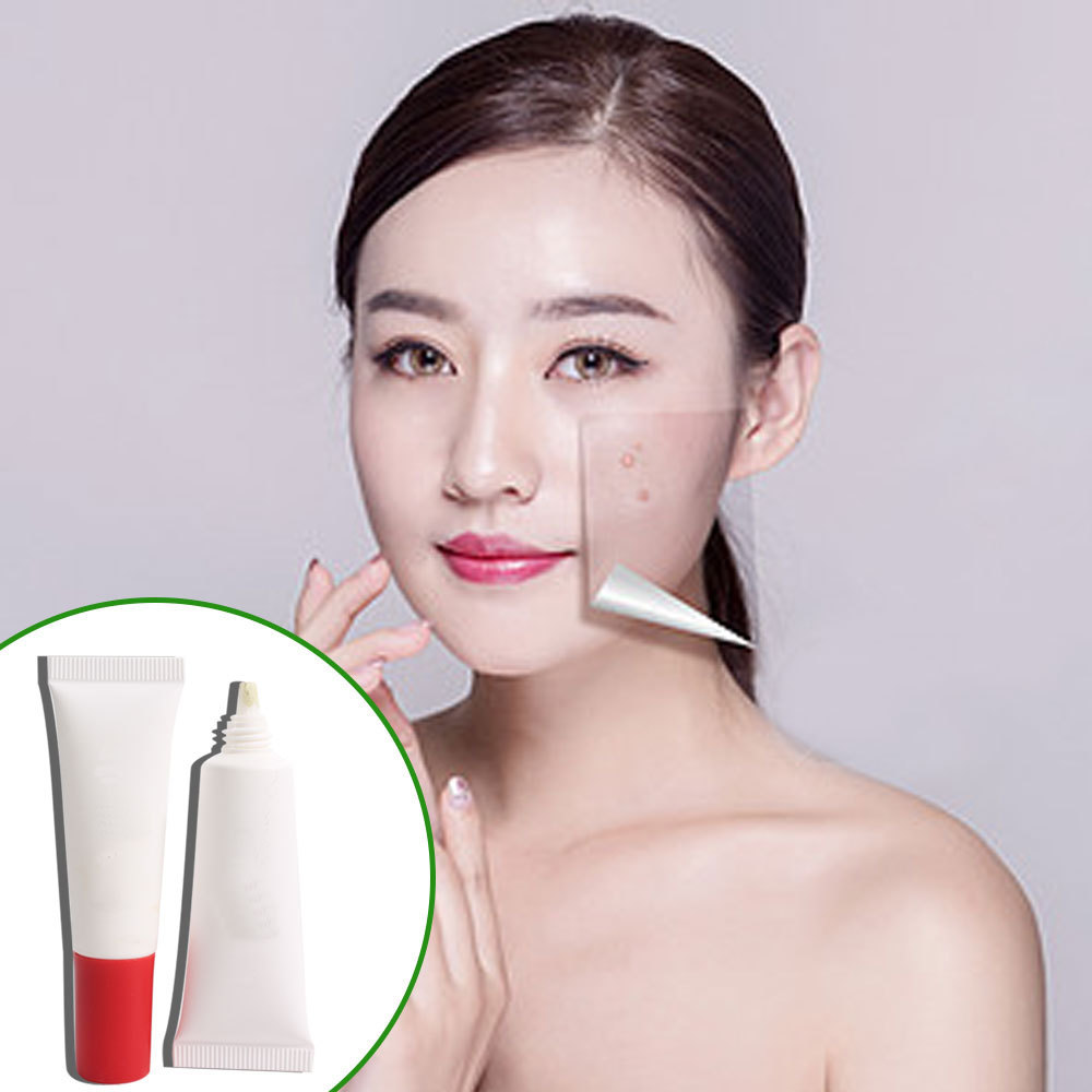 Acne Scar Removing Cleansing Pimple Remover Cream For Old Scars On Face