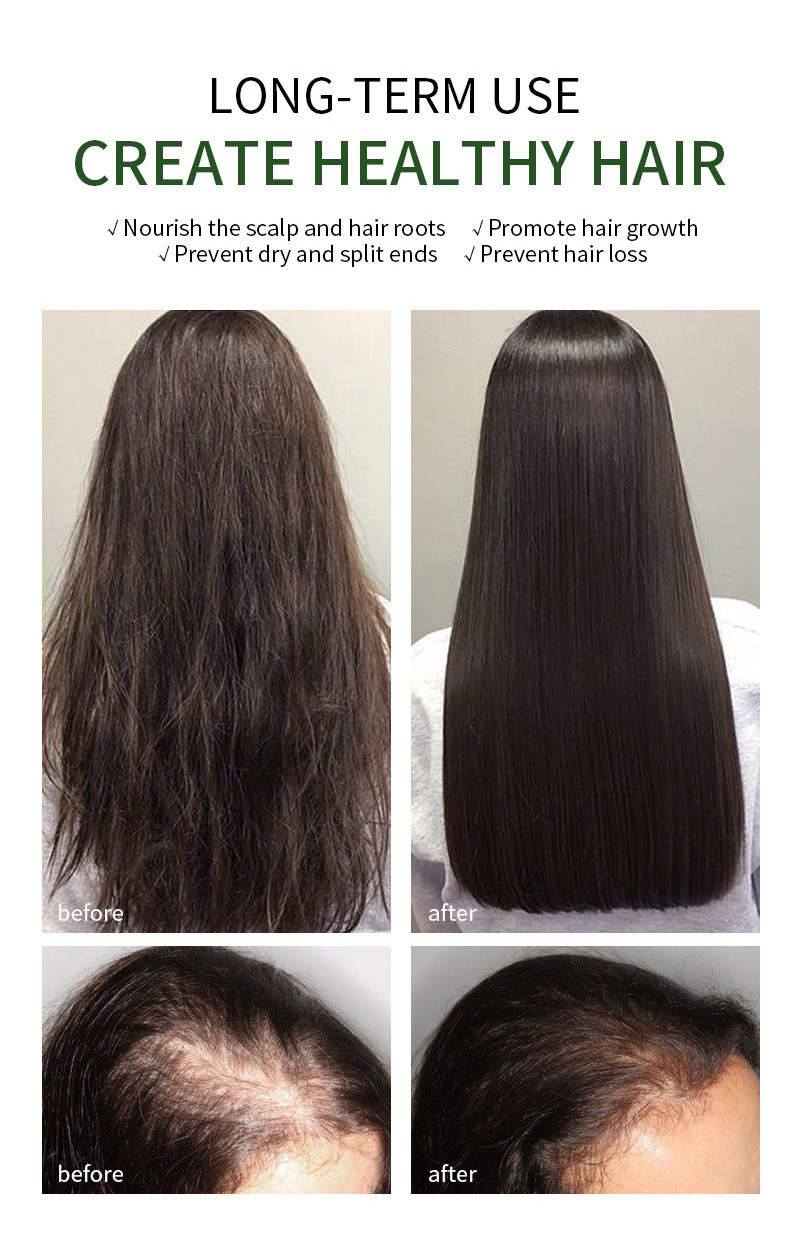 Hair Growth Products Private Label Rosemary Oil Hair Oils For Hair Growth