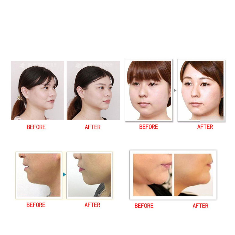 Reduce Double Chin V Line Face Shaper Facial Anti Wrinkle Elastic Face Slimming Bandage