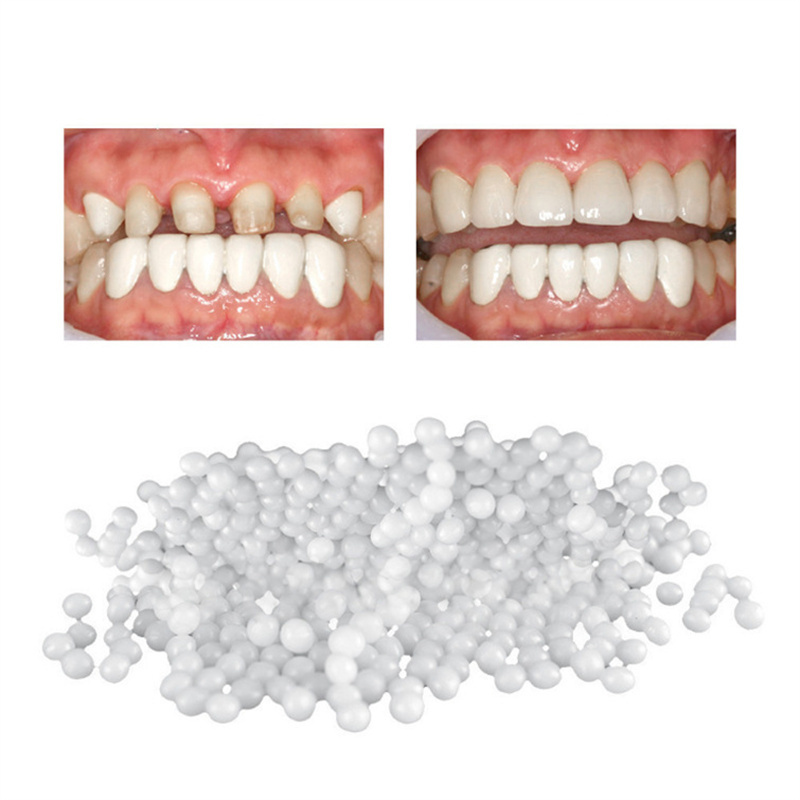 New Dental Restoration Reusable Moldable Temporary False Teeth Solide Glue 20ml Repair Teeth And Gaps Braces Adhesives