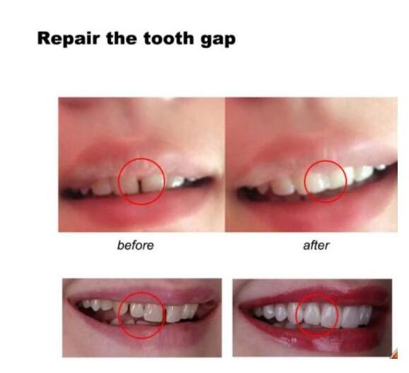 10g/20g Temporary Tooth Repair Kit Teeth And Gaps FalseTeeth Solid Glue Denture Adhesive Teeth Whitening Tooth Beauty Tool