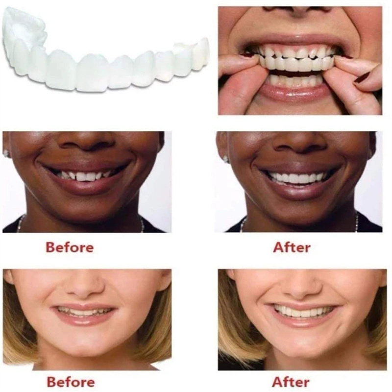 Teeth Veneers Whitening Dentures Imitation Braces Temporary False Teeth Cover Perfect Smile Comfortable Fit Denture Veneers Kit