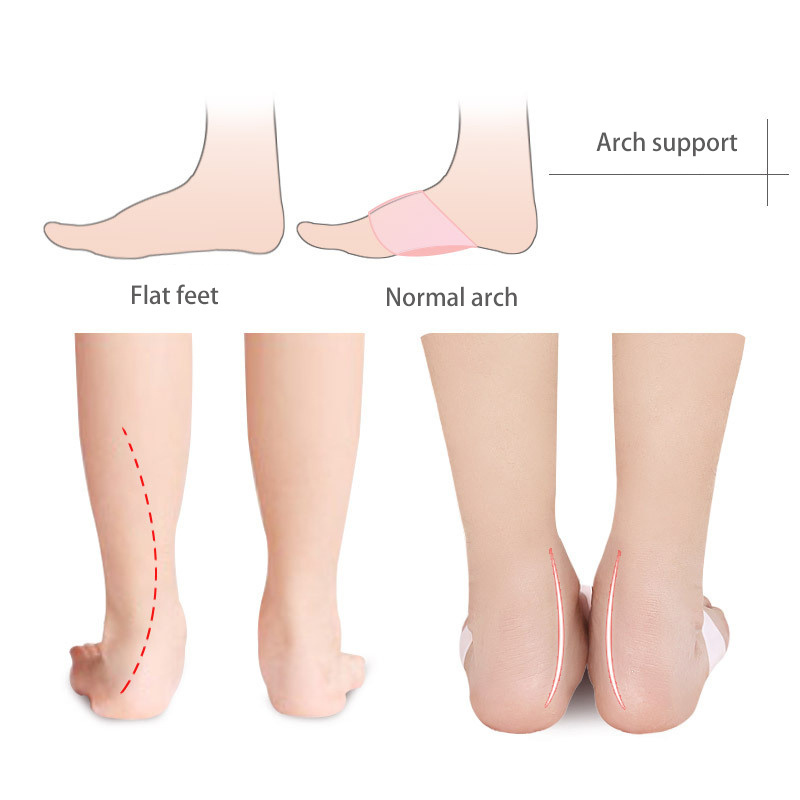 S-King Man And Women Half Arch Support Insole Flat Feet Silicone SEBS Foot Care Product