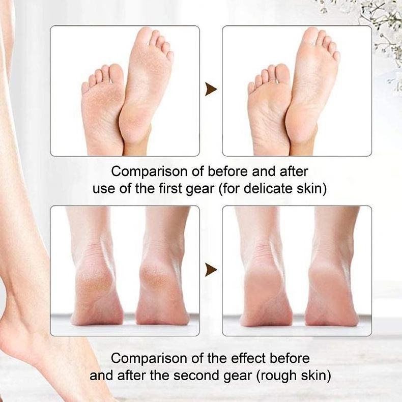 Rechargeable Electric Foot Callus Remover Pedicure Machine Foot Grinder Tools Files Clean Tools for Hard Cracked Skin