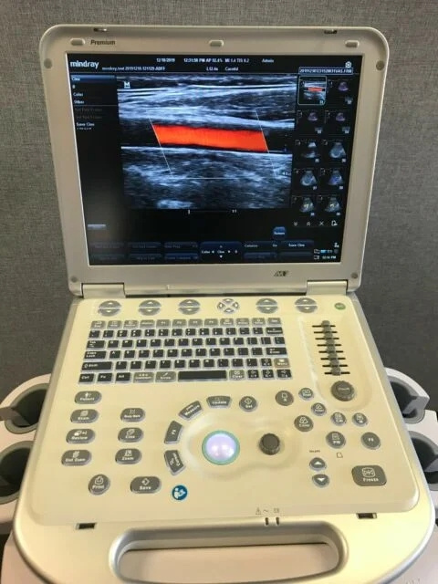 Mindray M7 Portable Medical Ultrasound in China