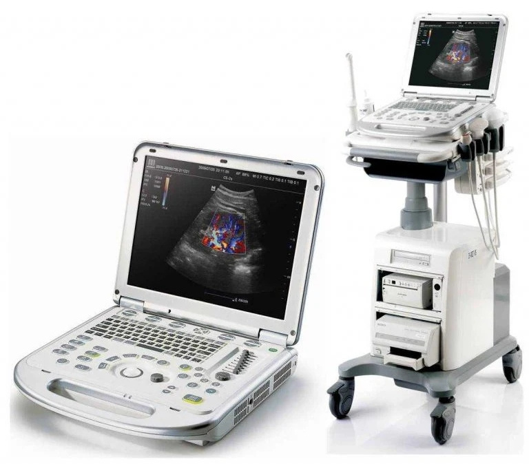 Mindray M7 Portable Medical Ultrasound in China