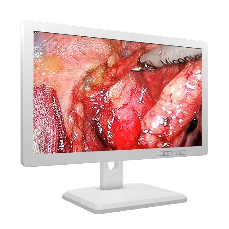 medical grade screen 4k medical grade monitor for cystoscope camera