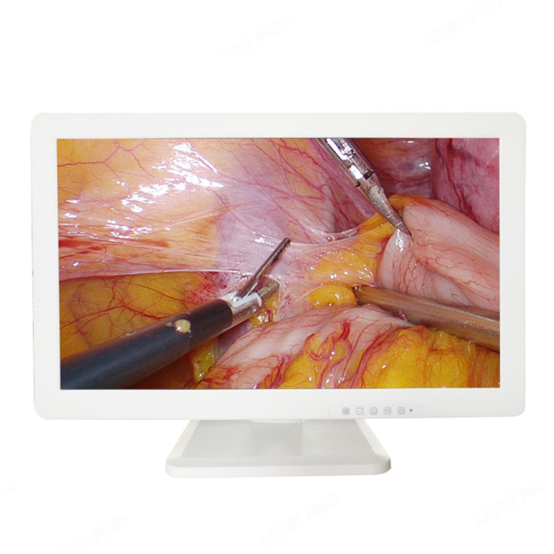 32 inch 3 d medical grade monitor for surgery images