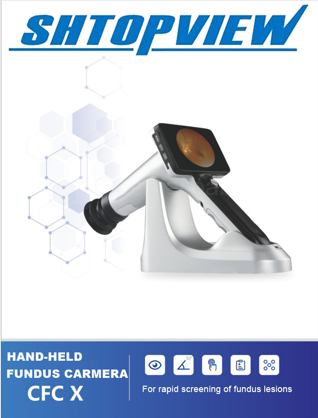 TOPVIEW CFC-X NEW Fundus Camera Digital Retinal portable handheld fundus camera for rapid sceening of fundus lesions