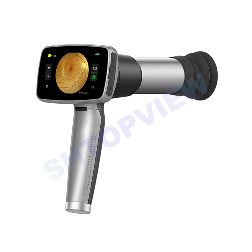 Portable Fundus Camera  New Model Excellent non-mydriatic automatic Handheld Digital eye Fundus Camera HFC-2