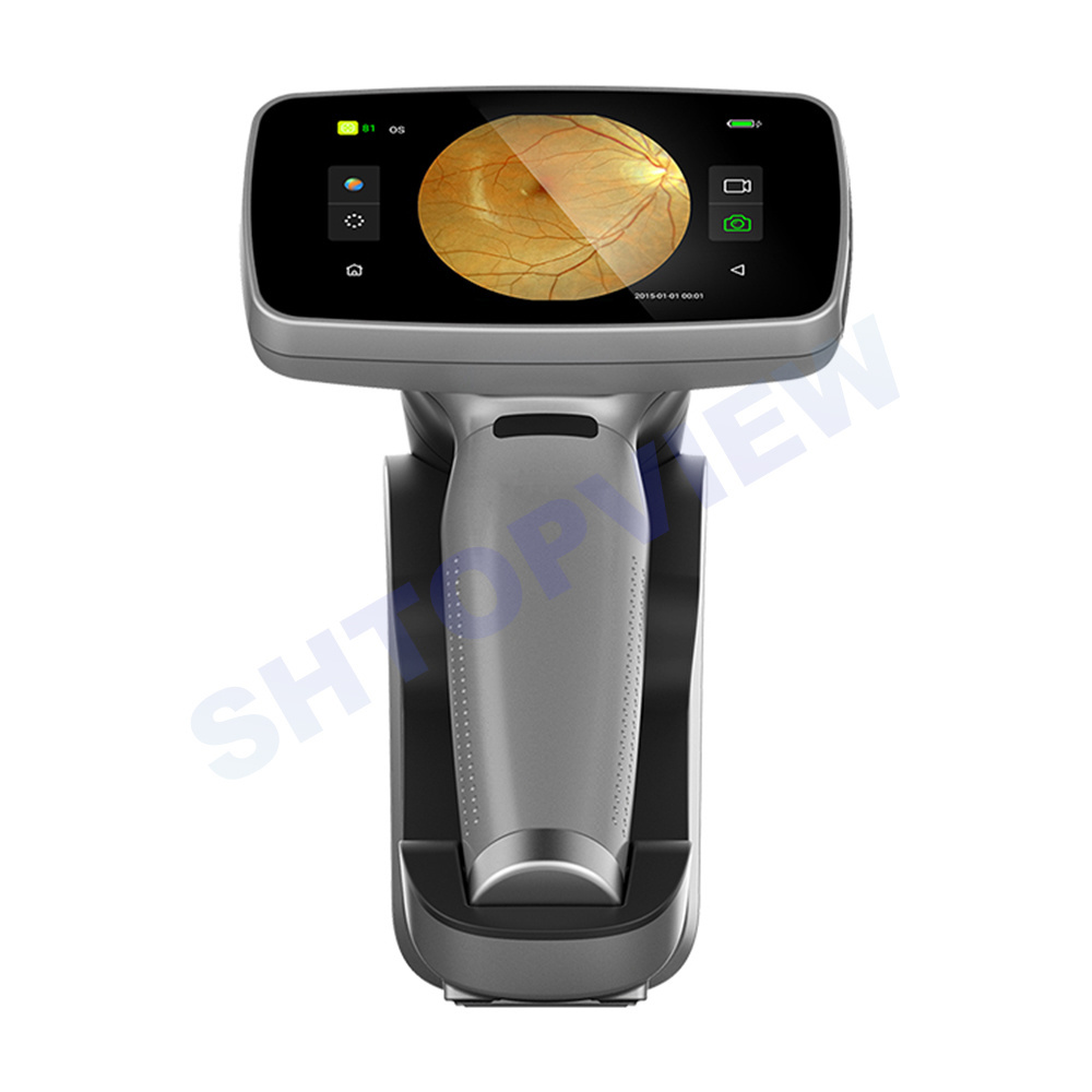 Portable Fundus Camera  New Model Excellent non-mydriatic automatic Handheld Digital eye Fundus Camera HFC-2