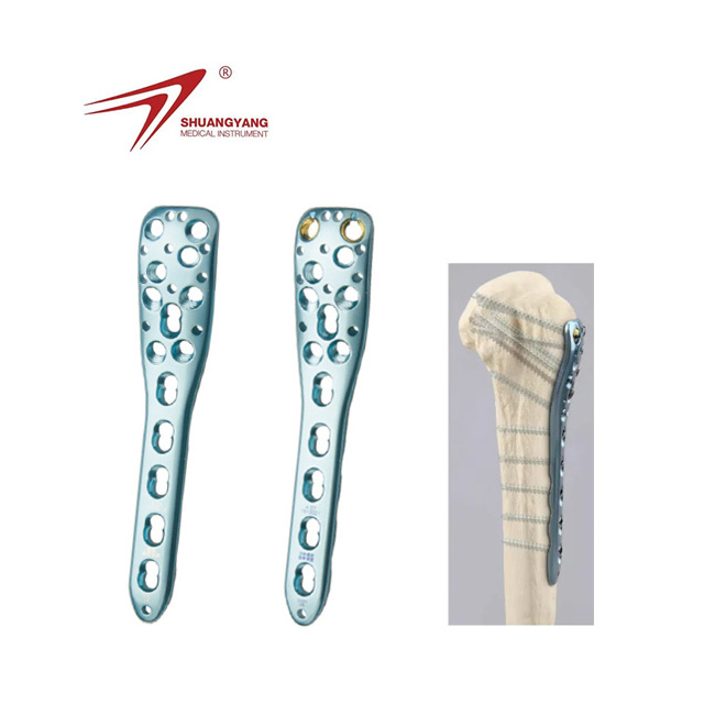 Proximal Humerus Locking Bone Plate (variable angle) - Titanium Orthopedic Implant