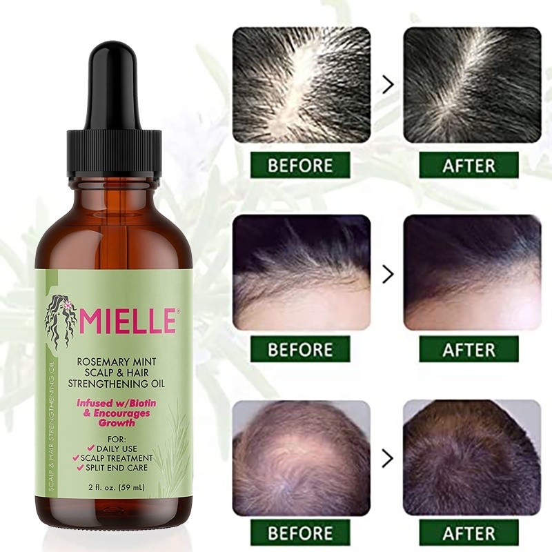 ODM/OEM Hair Growth Essential Oil Rosemary Mint Hair Strengthening Oil Nourishing Treatment for Split Ends and Dry Organics Hair