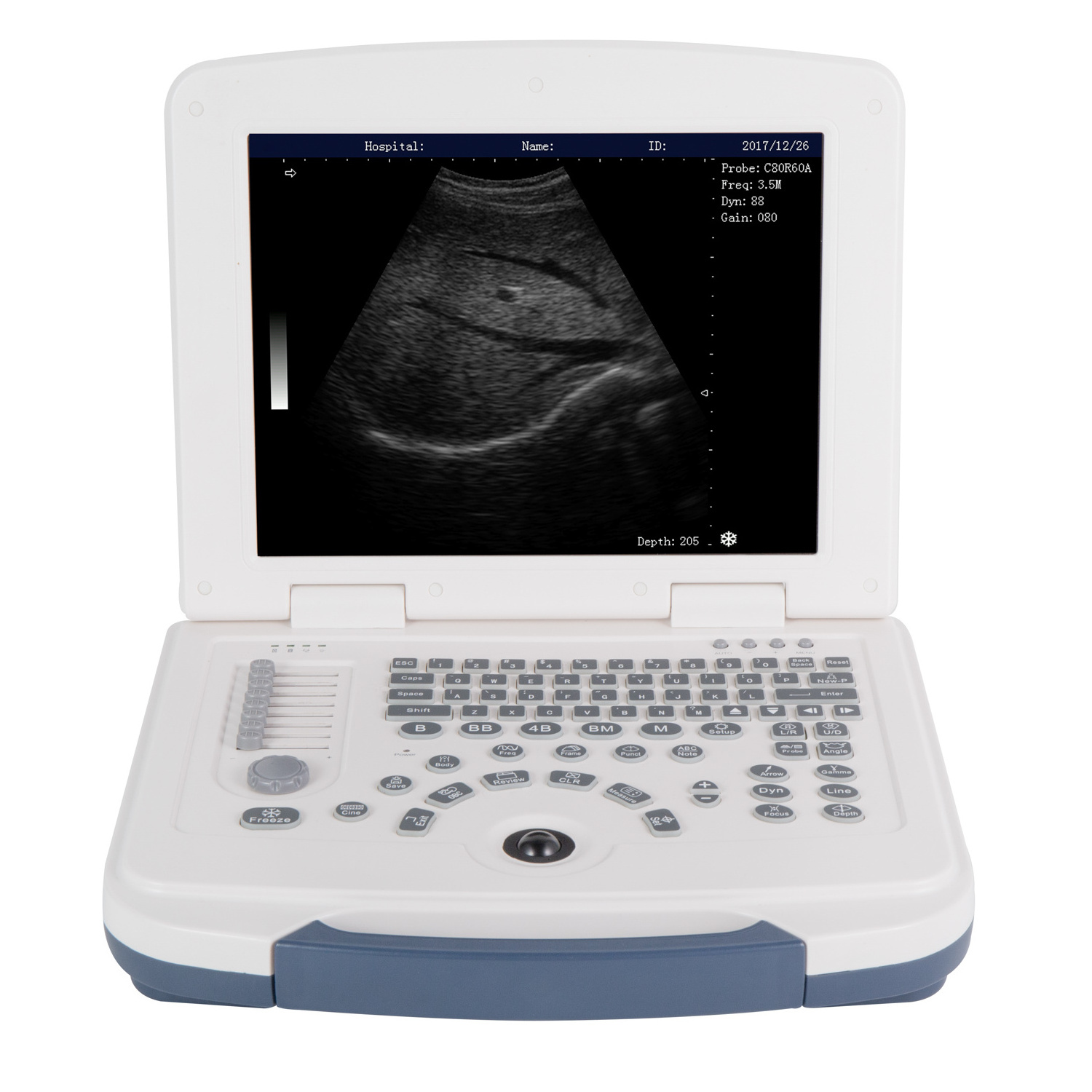 Sinoland wanl-580 Black And White Ultrasonic Small Size Portable Ultrasound machine ultrasonic Scanner With Convex Probe