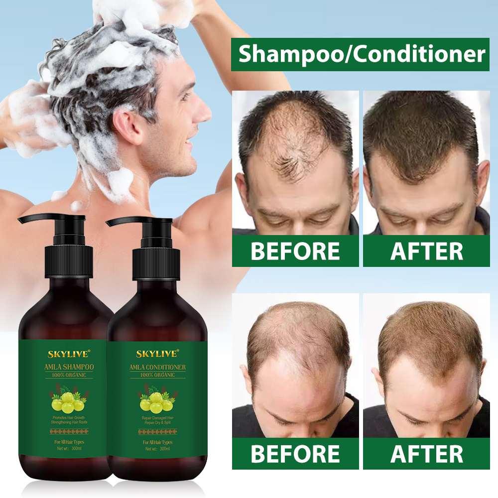 Wholesale Popular Anti Hair Loss Shampoo Nourishing Rosemary Conditioner Hair Growth Amla Oil Shampoo Amla Oil Set