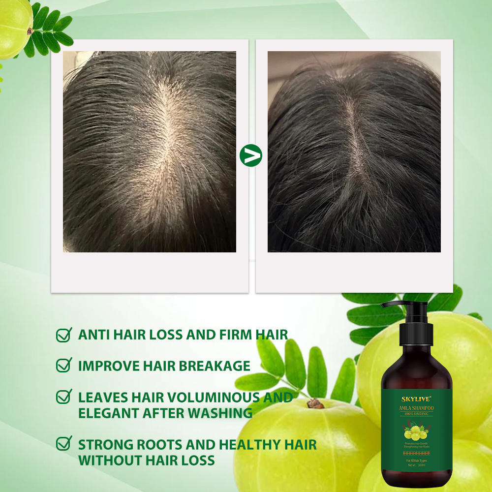 Wholesale Popular Anti Hair Loss Shampoo Nourishing Rosemary Conditioner Hair Growth Amla Oil Shampoo Amla Oil Set