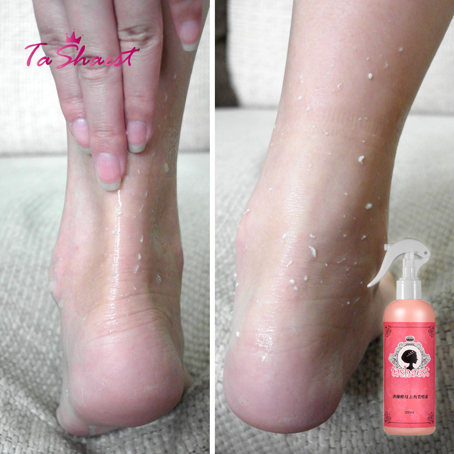 Beauty foot exfoliating scrub spray natural body scrub