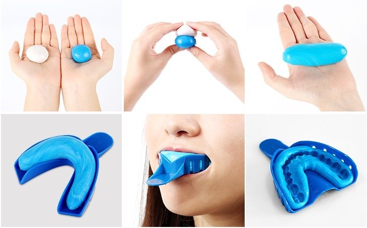 SMILE Dentist Dental Silicone Impression Materials Tooth Tray Impression Putty Kit