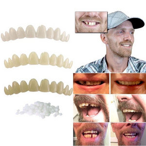 Instantly Smile Artificial Teeth Complete Your Smile Temporary Tooth Replacement Kit - Replace a missing tooth in minutes