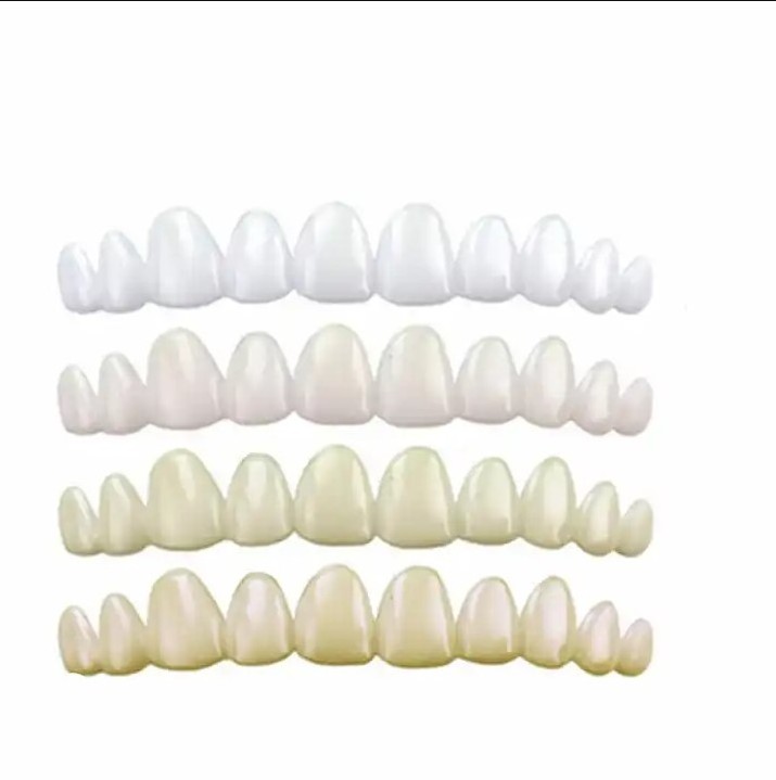 Instantly Smile Artificial Teeth Complete Your Smile Temporary Tooth Replacement Kit - Replace a missing tooth in minutes