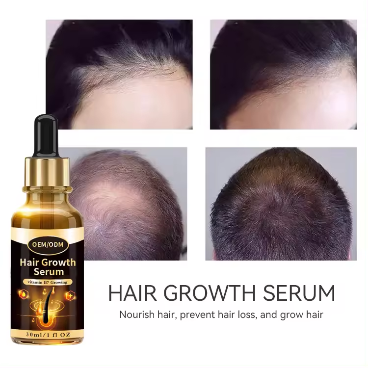 Custom Logo Private Label Hair Care Argan Oil Vitamin Essence Promote Hair Growth Oil With Positive Effect